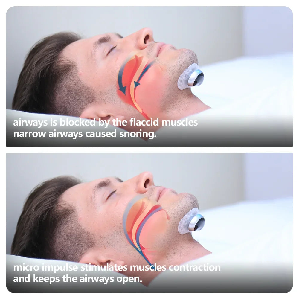 Anti Snoring Smart Device for Adult Sleep Aid to Stop Snoring Analyze Sleep and Snoring Data Wirelessly