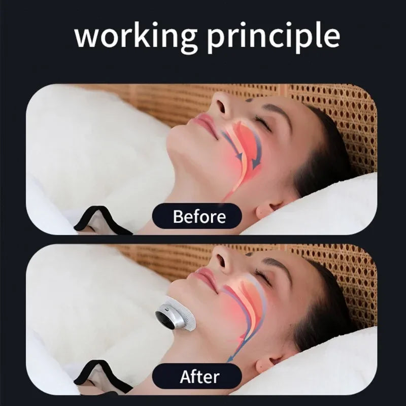Smart Electric Anti Snoring Device Portable Sleep Apnea Improve Dual Pulse Snore Stopper Throat Muscle Stimulator Sleep Aid Tool