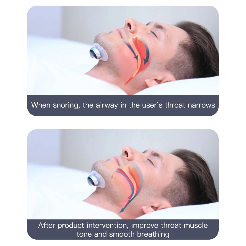Anti Snoring Smart Device for Adult Sleep Aid to Stop Snoring Analyze Sleep and Snoring Data Wirelessly