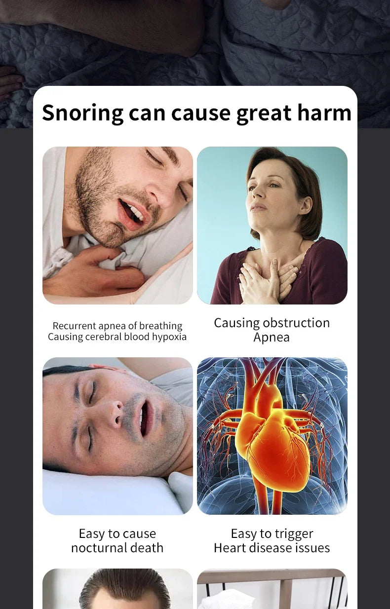 Smart Electric Anti Snoring Device Portable Sleep Apnea Improve Dual Pulse Snore Stopper Throat Muscle Stimulator Sleep Aid Tool